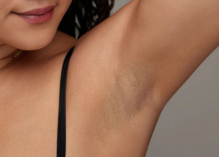 Pocket IPL Hair Removal Device